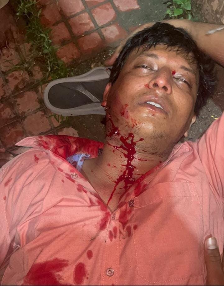 చింతల్ బ్రిడ్జిపై ఘోర రోడ్డు ప్రమాదం.. 30 ఏళ్ల యువకుడు మృతి